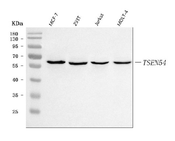 TSEN54 Antibody