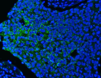 Anti-PITPNB Antibody