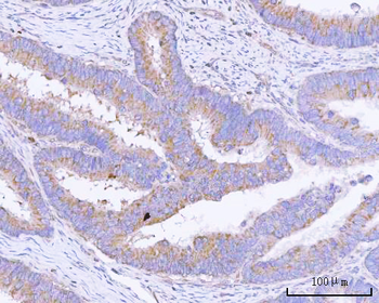 Anti-PITPNB Antibody
