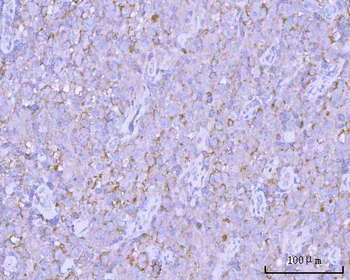 Anti-PITPNB Antibody