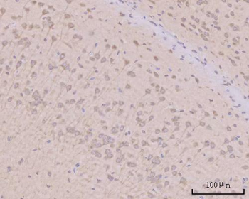 Anti-PITPNB Antibody