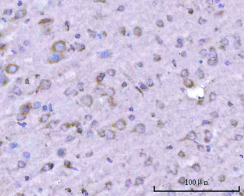 Anti-PITPNB Antibody
