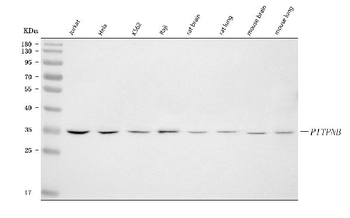 Anti-PITPNB Antibody