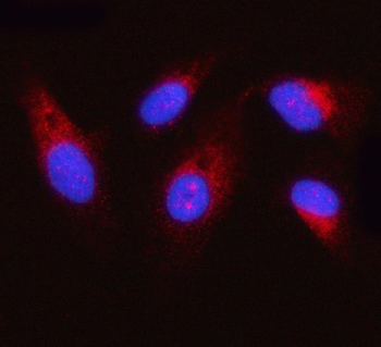 Anti-OXSM Antibody
