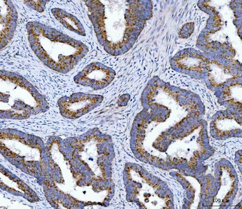 Anti-OXSM Antibody