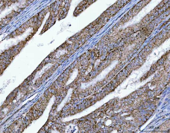 Anti-OXSM Antibody