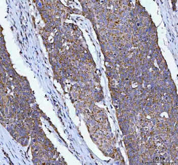 Anti-OXSM Antibody