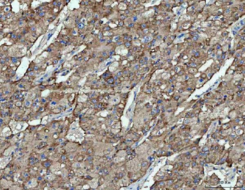Anti-OXSM Antibody