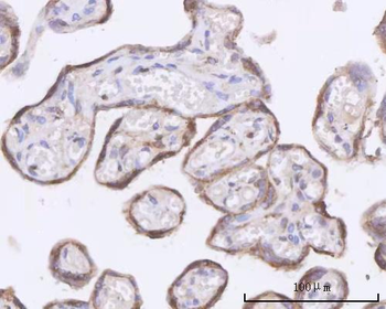 Anti-OXCT2 Antibody