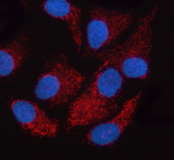 OXCT2 Antibody