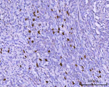Anti-BSAP/PAX5 Antibody