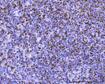Anti-BSAP/PAX5 Antibody