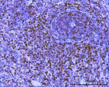 Anti-BSAP/PAX5 Antibody