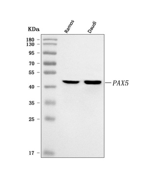 BSAP/PAX5 Antibody