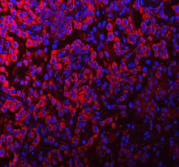 Anti-PACSIN2 Antibody