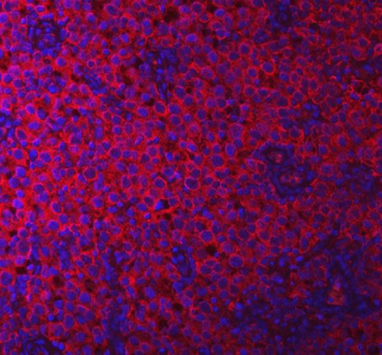 Anti-PACSIN2 Antibody