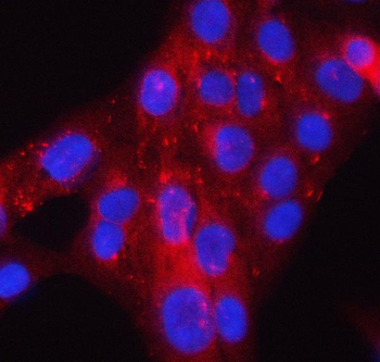 Anti-PACSIN2 Antibody