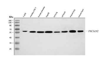 Anti-PACSIN2 Antibody