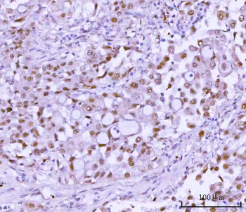 Anti-RSBN1 Antibody