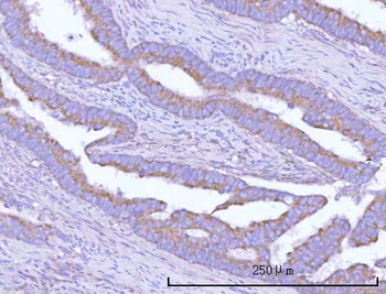 Anti-OSGIN1 Antibody