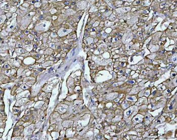 Anti-OSGIN1 Antibody