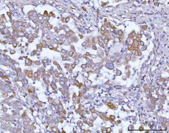Anti-OSGIN1 Antibody