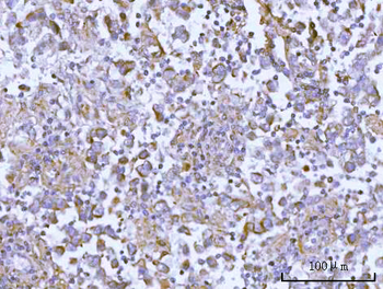 Anti-OSGIN1 Antibody