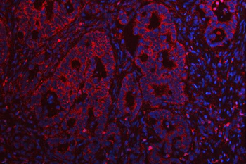 Anti-TMEM132B Antibody