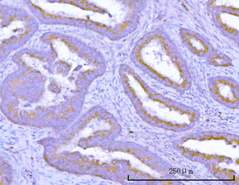 Anti-TMEM132B Antibody