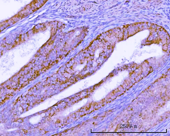 Anti-TMEM132B Antibody