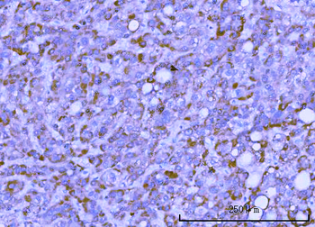 Anti-TMEM132B Antibody