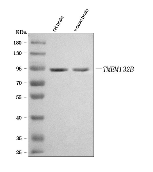 Anti-TMEM132B Antibody