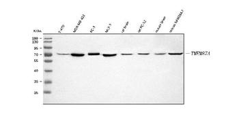 Anti-TMEM87A Antibody