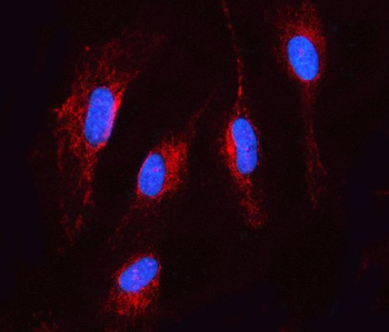 Anti-TMEM87A Antibody