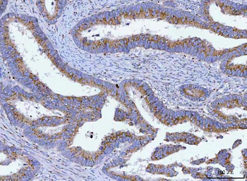 Anti-TMEM87A Antibody