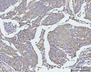Anti-TMEM87A Antibody