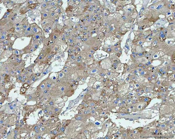Anti-TMEM87A Antibody