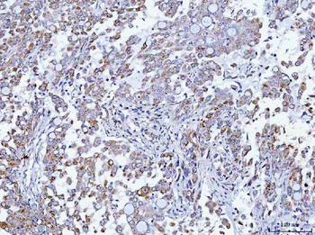 Anti-TMEM87A Antibody