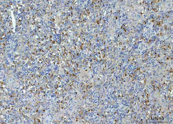 Anti-TMEM87A Antibody