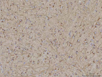 Anti-TMEM87A Antibody
