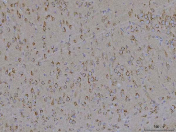 Anti-TMEM87A Antibody
