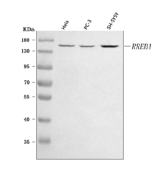 Anti-RREB1 Antibody