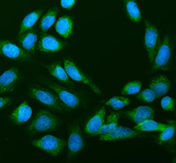 Anti-RPS14 Antibody