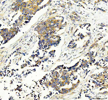 Anti-RPS14 Antibody