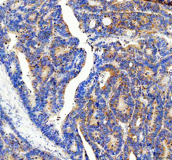 Anti-RPS14 Antibody