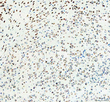 Anti-RPS14 Antibody