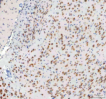 Anti-RPS14 Antibody