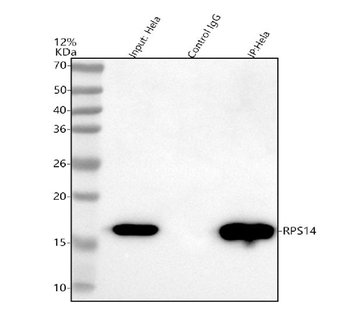 Anti-RPS14 Antibody