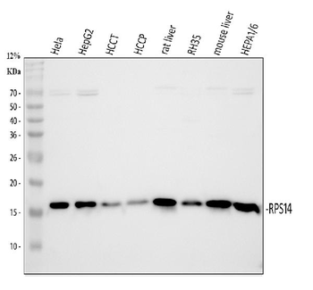 Anti-RPS14 Antibody