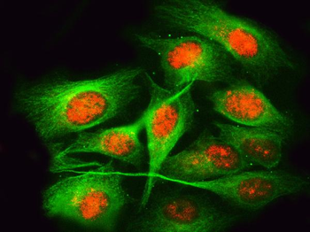 Anti-RPRD1B Antibody